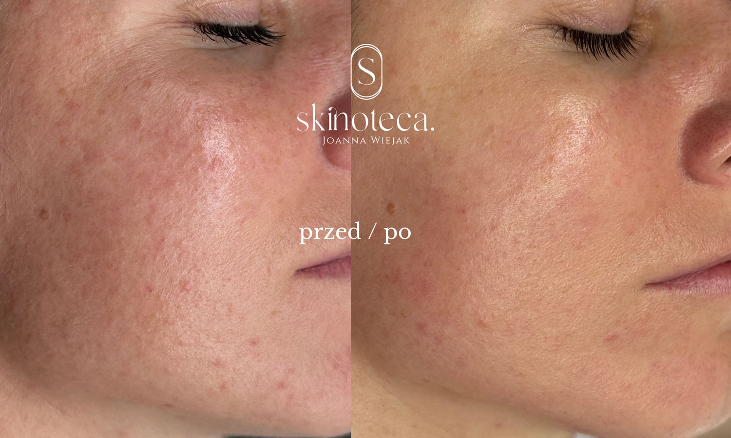 przed / po – kopia - 1