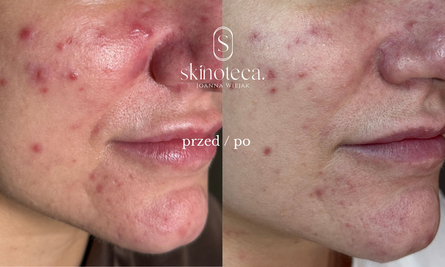 przed / po – kopia - 1