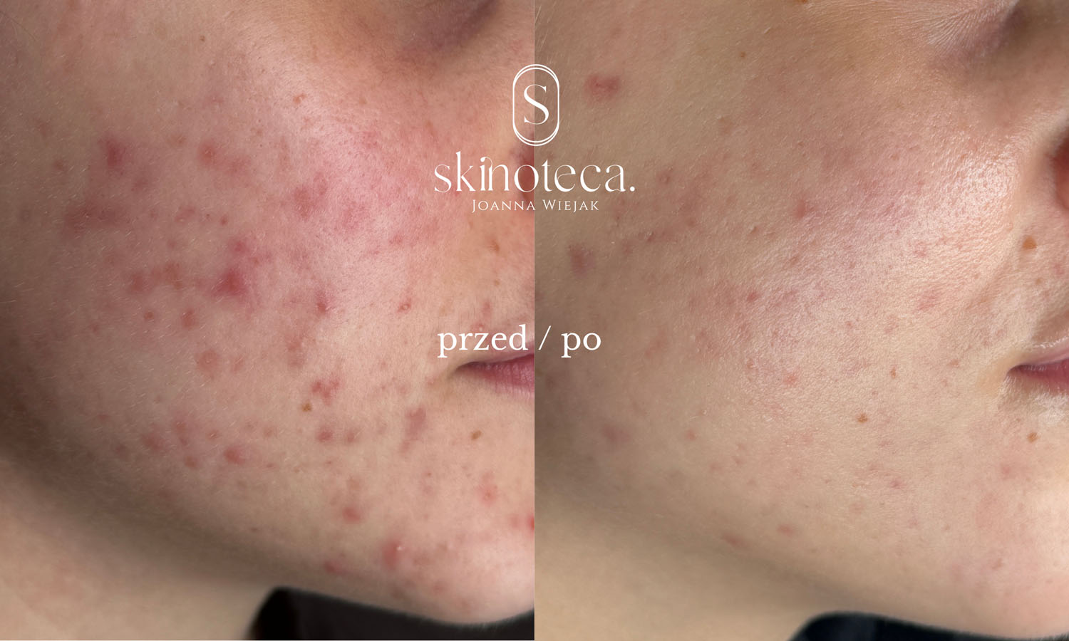 przed / po – kopia - 1