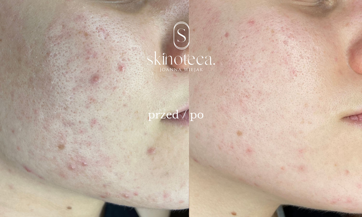 przed / po – kopia - 1
