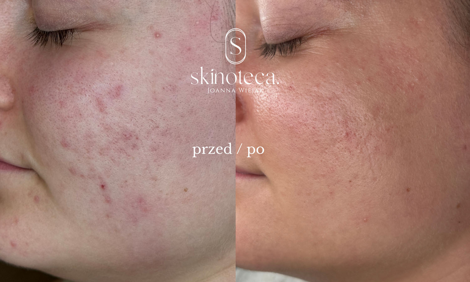 przed / po – kopia - 1