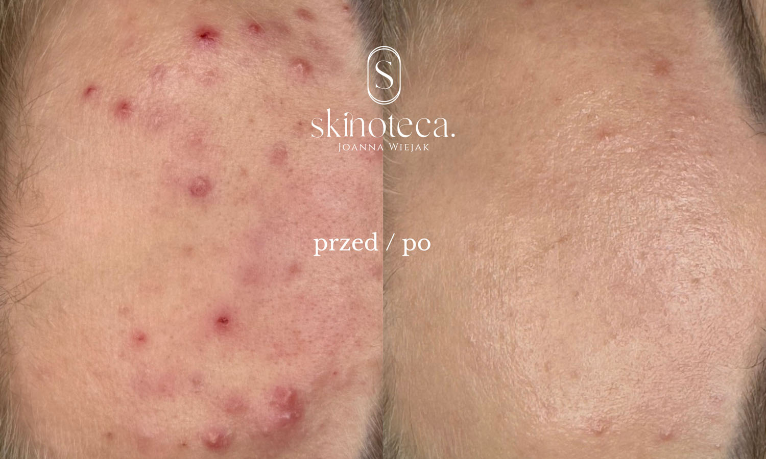 przed / po – kopia - 1