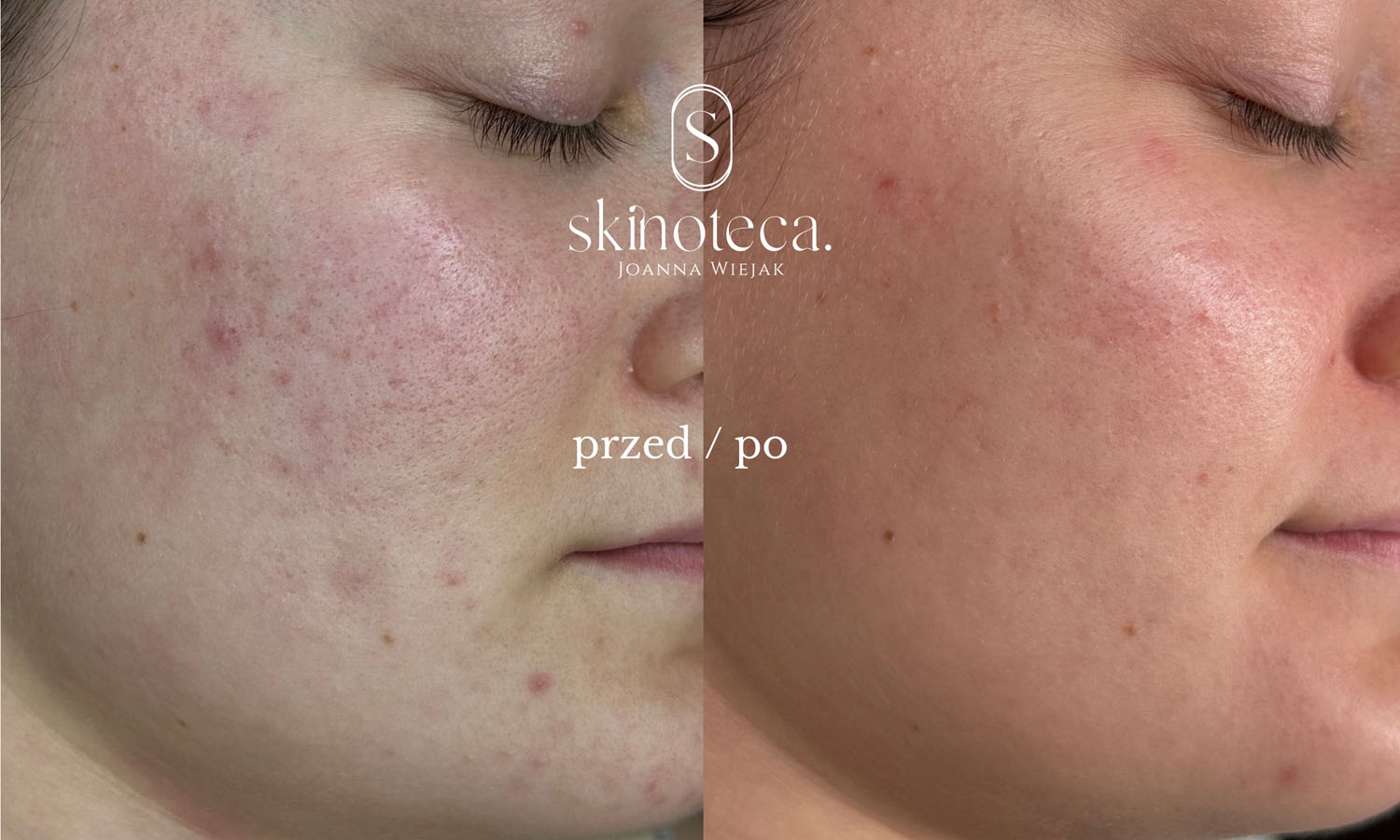 przed / po – kopia - 1