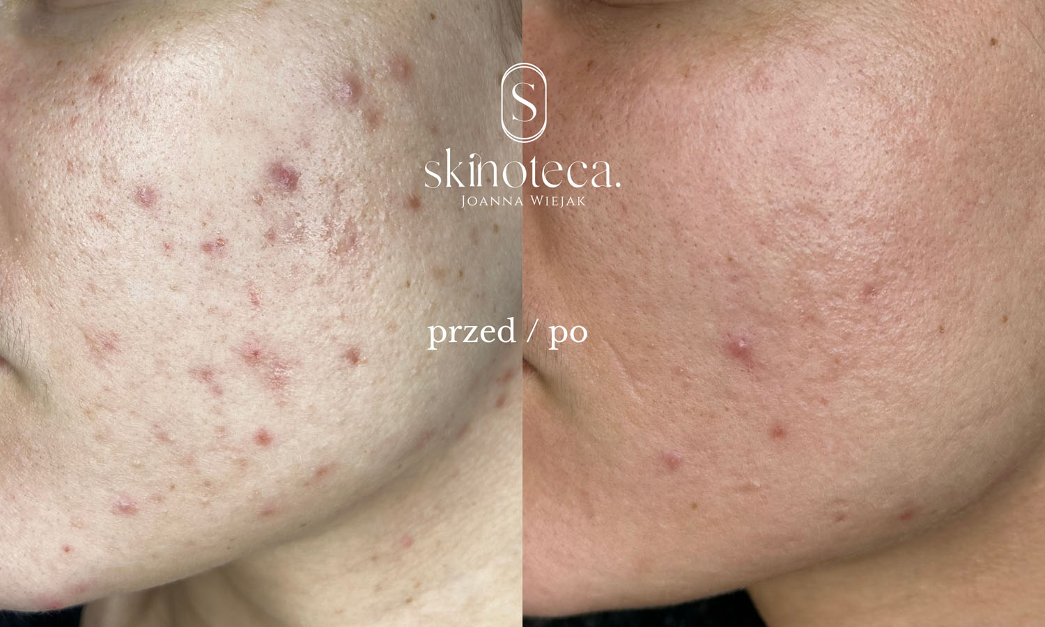 przed / po – kopia - 1