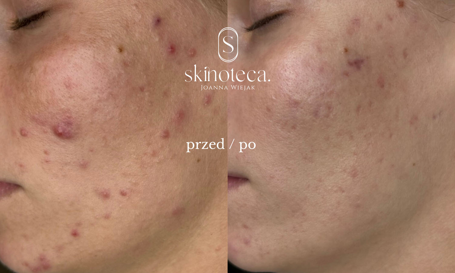 przed / po – kopia - 1