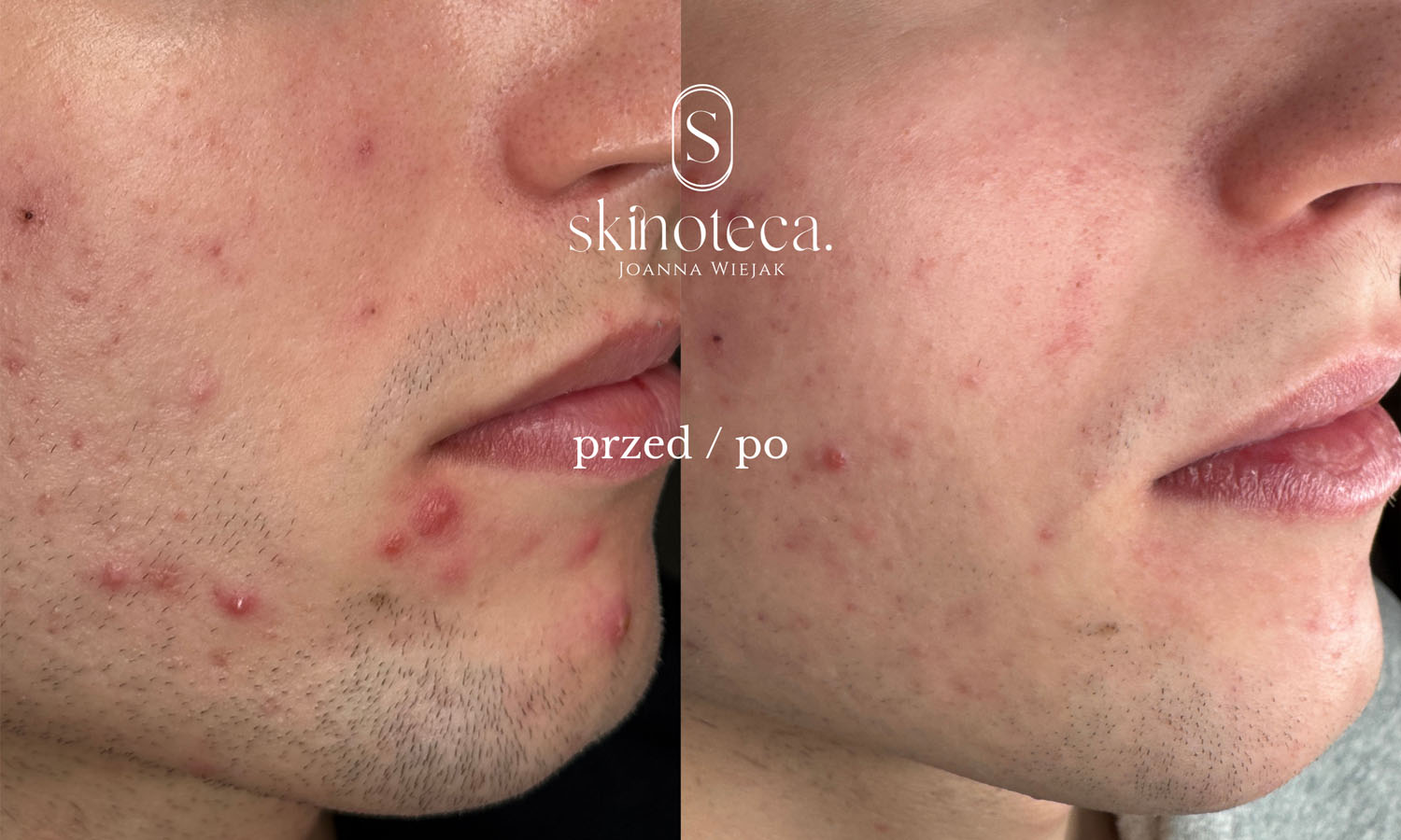 przed / po – kopia - 1