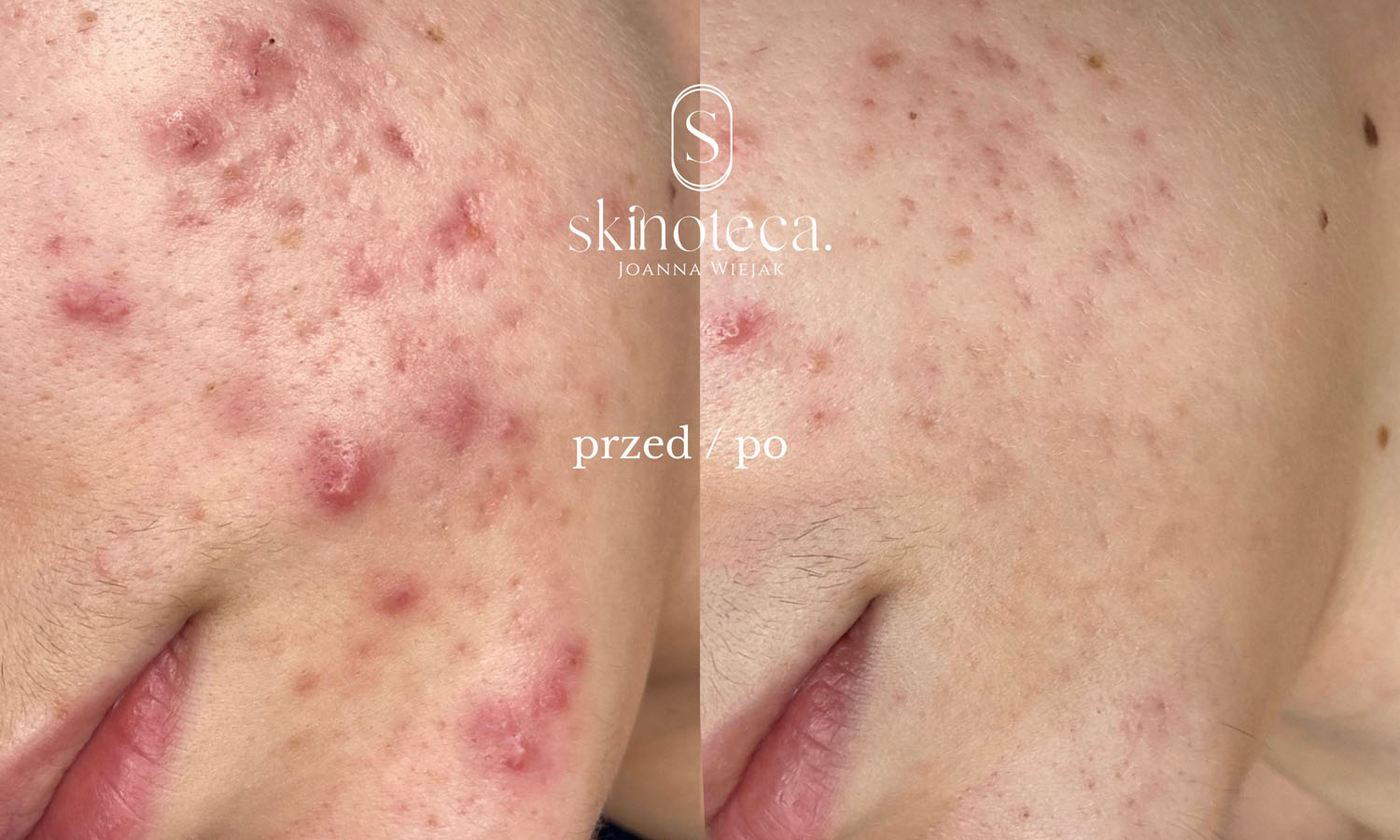 przed / po – kopia - 1