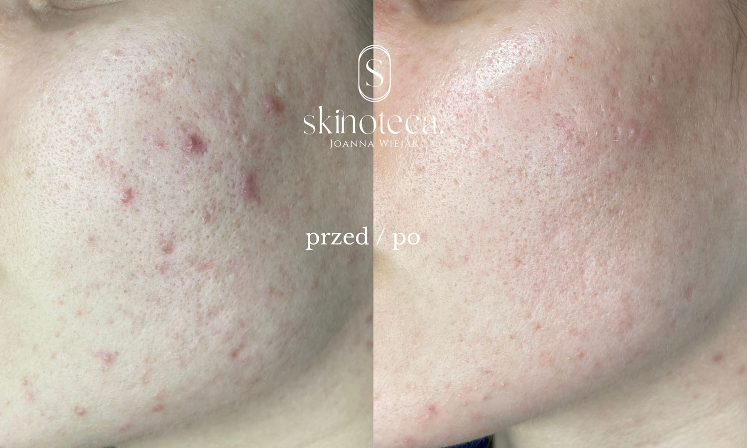 przed / po – kopia - 1
